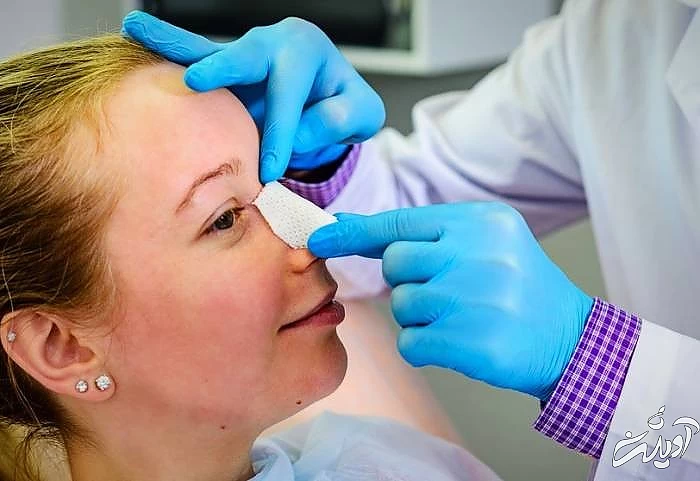 بعد از جراحی بینی